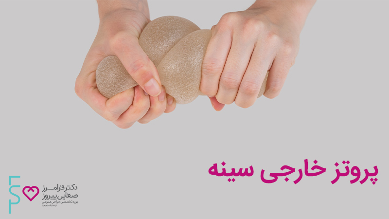 پروتز خارجی سینه پروتز خارجی سینه